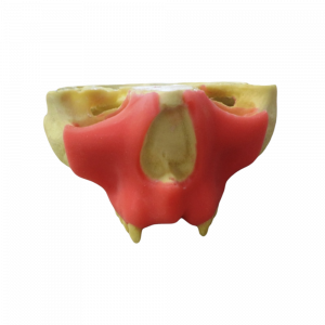MAXILA COM GENGIVA E  AUSÊNCIA DOS DENTES 11/12 / 21 E 22 - cód. 9971 SGT