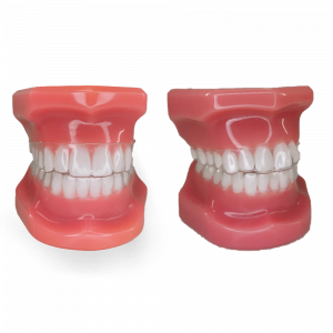 KIT DE MANEQUINS DEMONSTRATIVOS PARA ALINHADORES ORTODONTICOS
